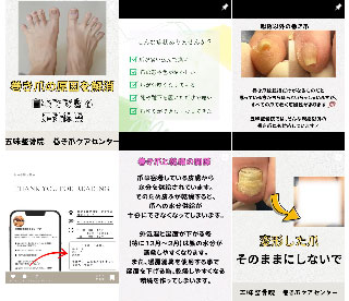 五味整骨院 巻き爪ケアセンター